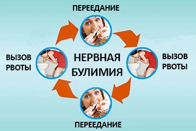 Лечение булимии в Новополоцке